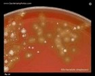 alfa hemolytic streptococci.jpg